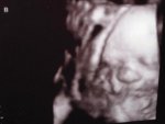baby B.jpg baby B.jpg