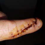 finger stiches_432X432.jpg